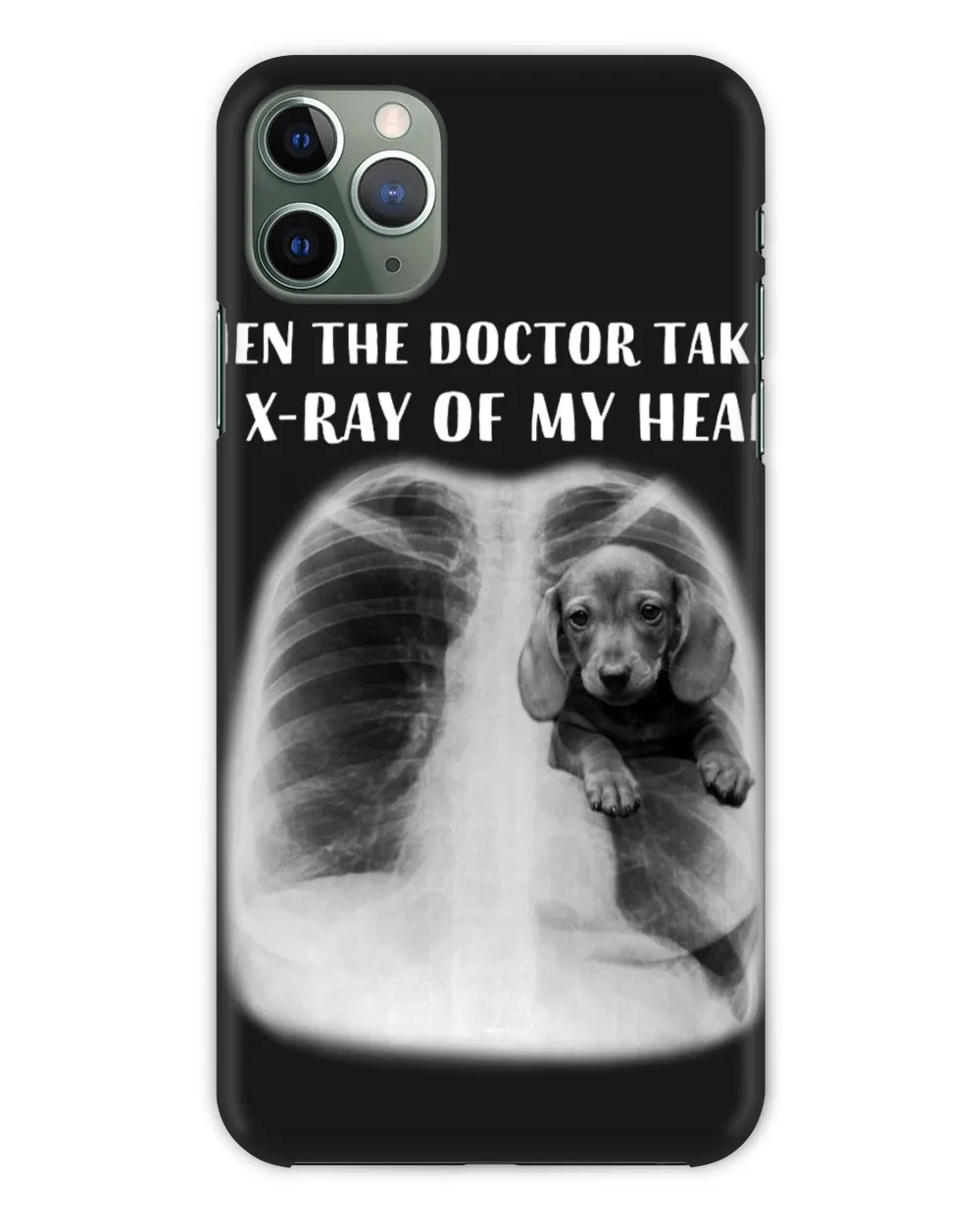 When The Doctor Takes An X-Ray Of My Heart Dachshund