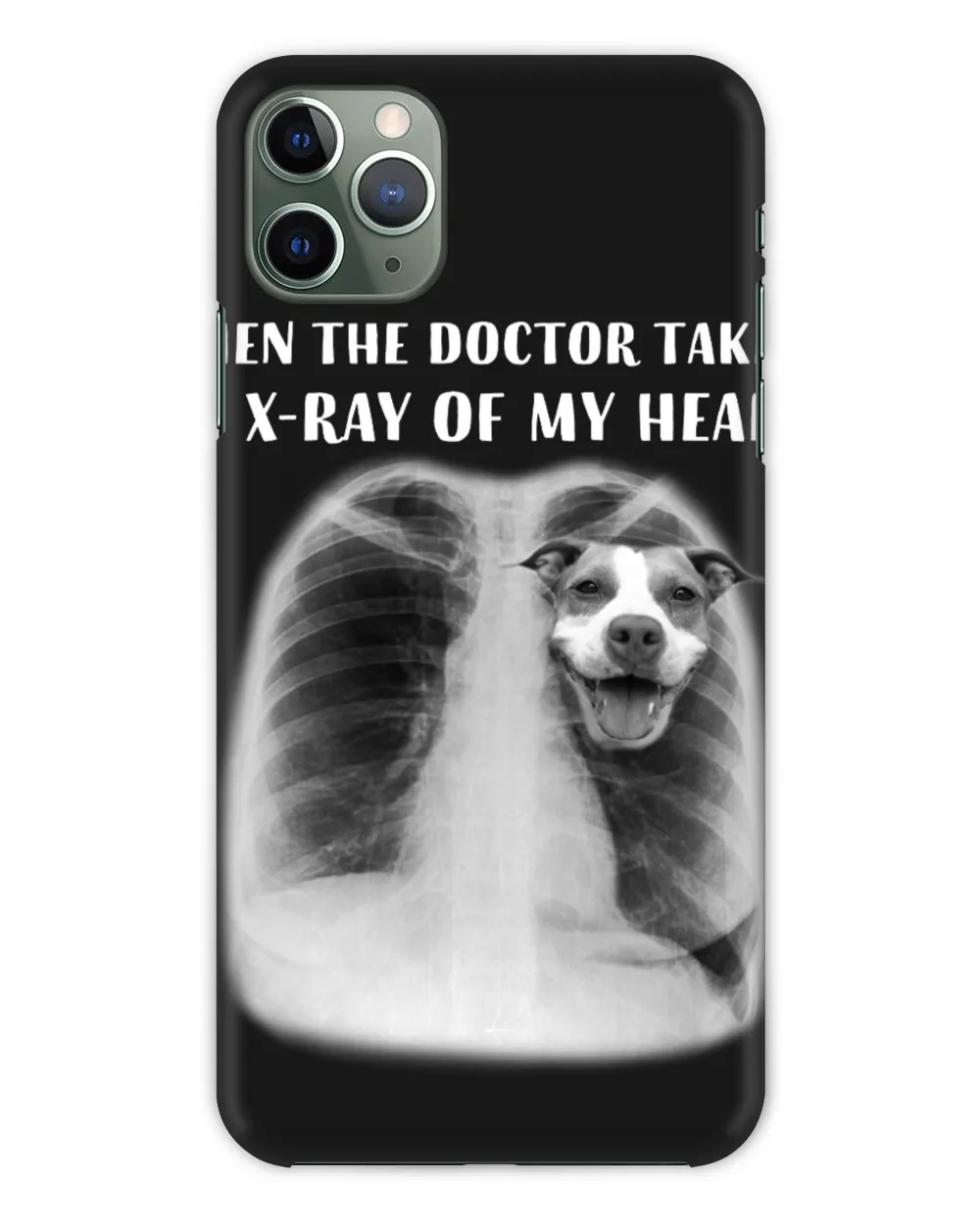 When The Doctor Takes An X-Ray Of My Heart Pitbull