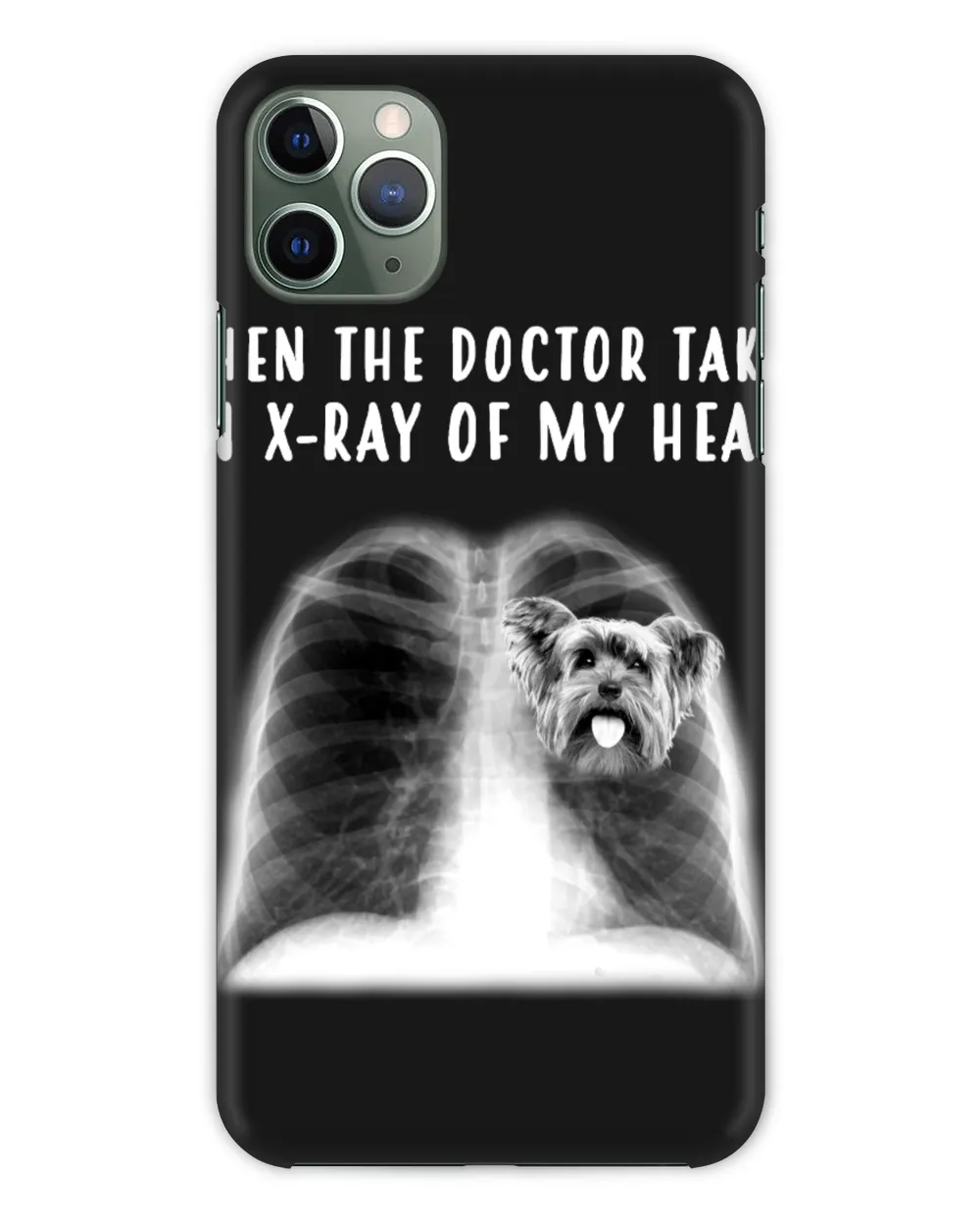 When The Doctor Takes An X-Ray Of My Heart Yorkshine