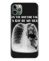 Snap Case - iP 11 Pro Max