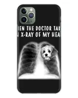 Snap Case - iP 11 Pro Max