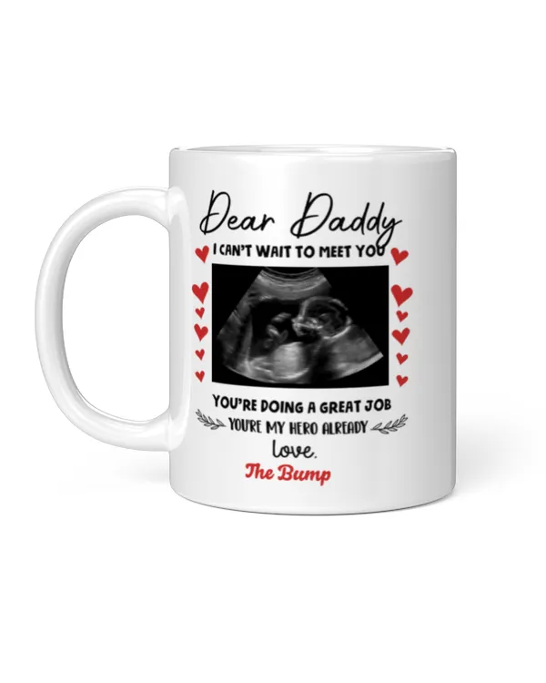 Wonderful Ultrasound Gift For Daddy to be Father’s Day Personalized Mug