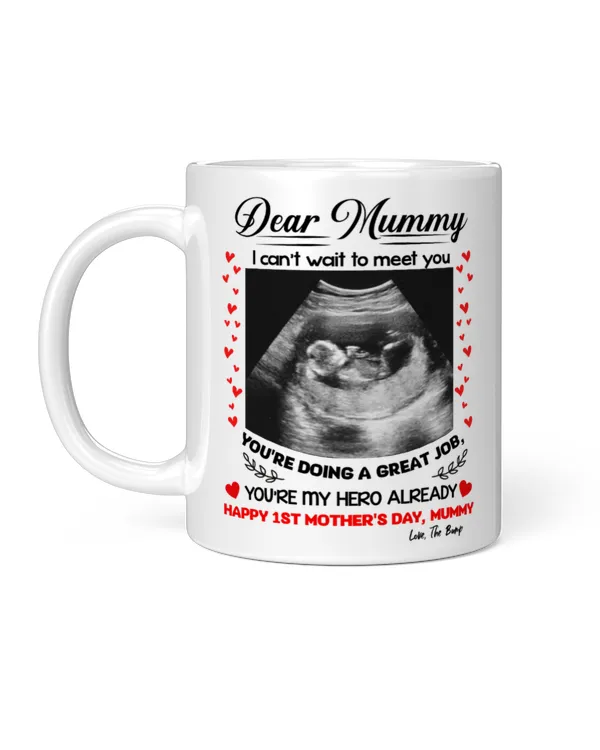 I Can't Wait To Meet You Mug 2