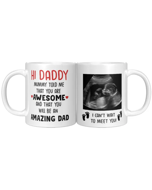 Custom Mug for Dad-to-Be | A Unique Gift for Expectant Fathers