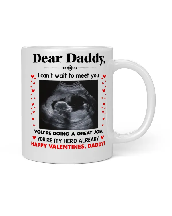 White Mug
