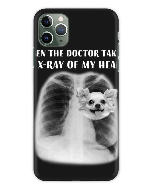 Snap Case - iP 11 Pro Max