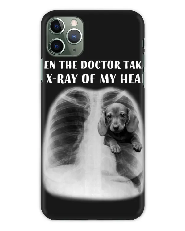 Snap Case - iP 11 Pro Max