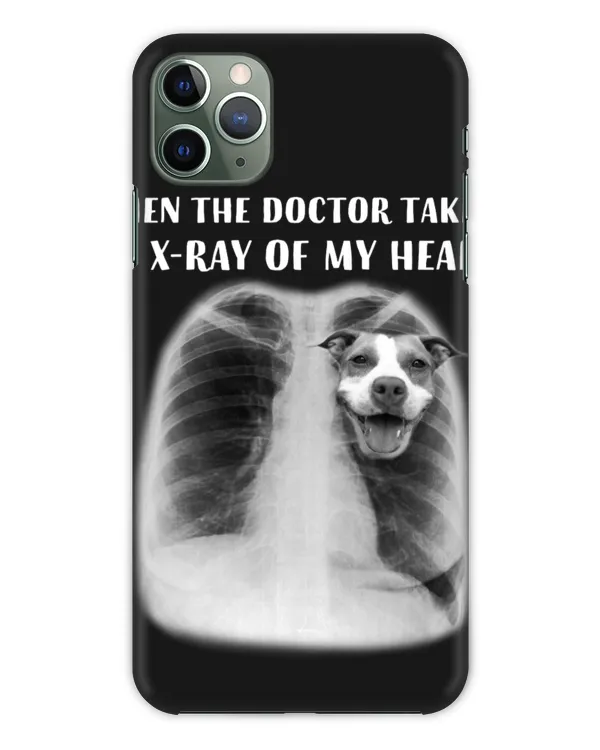 Snap Case - iP 11 Pro Max