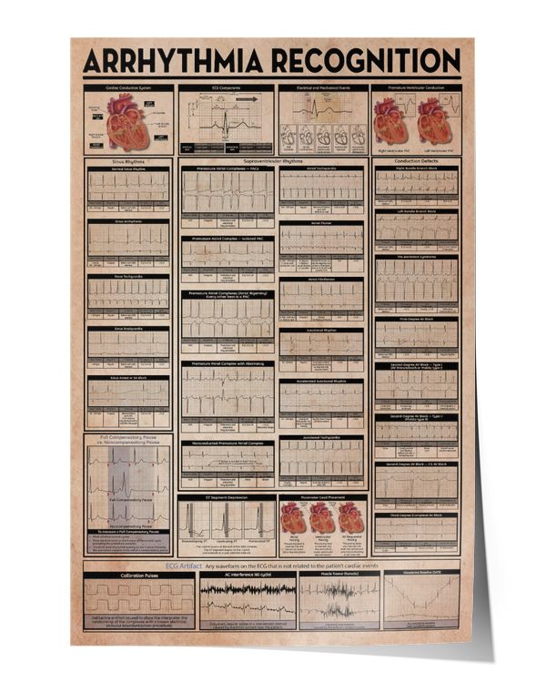 Arrhythmia Recognition Knowledge Wall Decor Artwork Print Poster Wall Art Print Home Decor Vintage