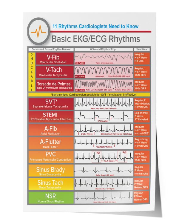 EKG.ECG Rhythms Knowledge Wall Decor Artwork Print Poster Wall Art Print Home Decor Vintage